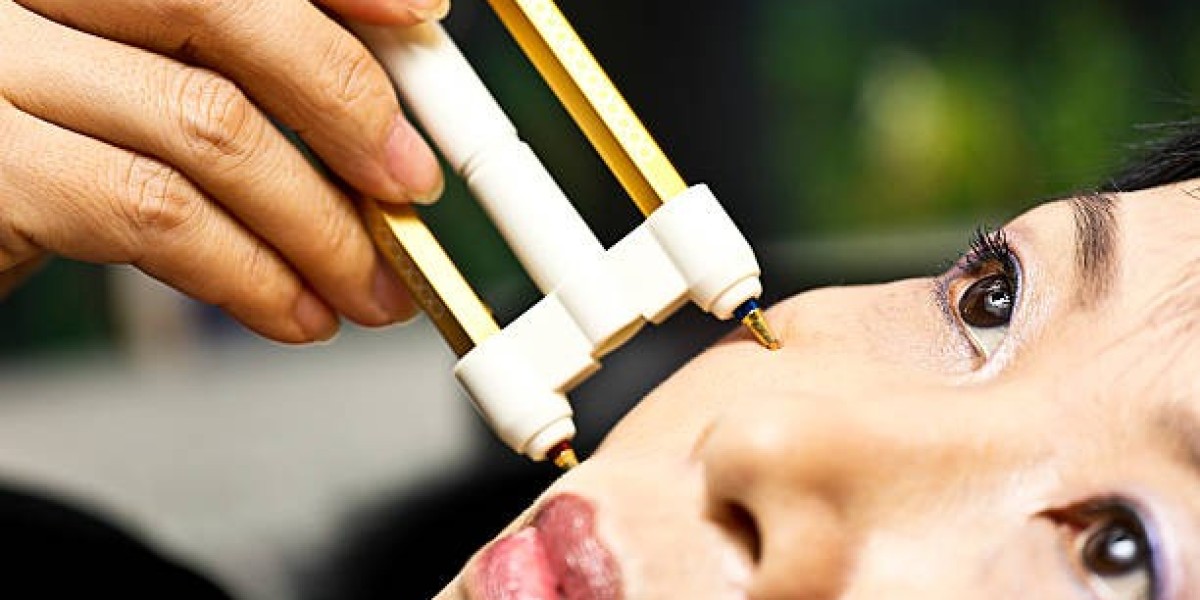 Plasma Pen Treatment in Dubai: Results, Recovery & Safety