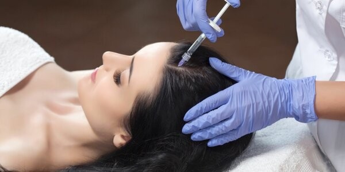 Plasma Injection for Hairs in Dubai Scalp Treatment Guide