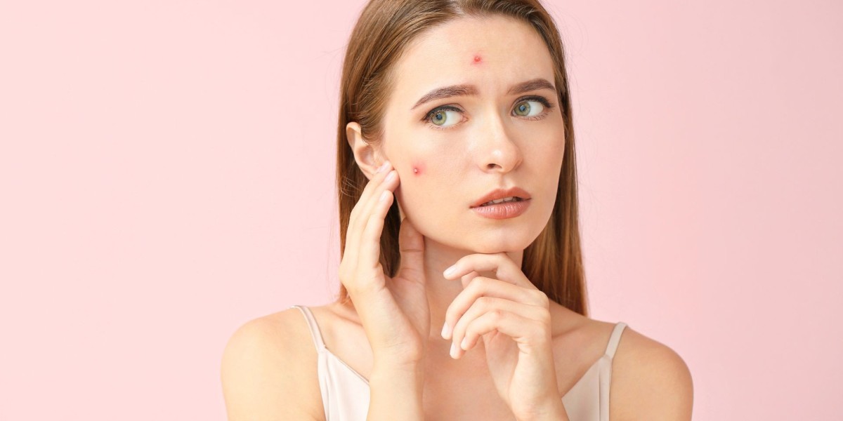 Acne Treatment in Dubai: Microneedling for Acne Scars