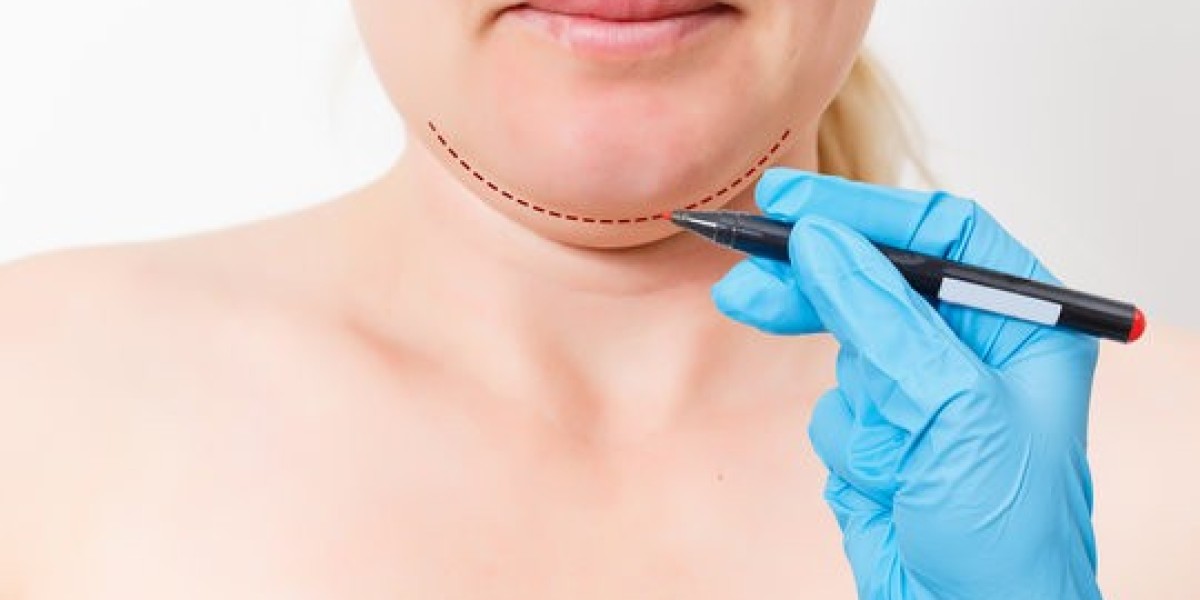 Safety First: Essential Questions for Your Chin Reduction Journey