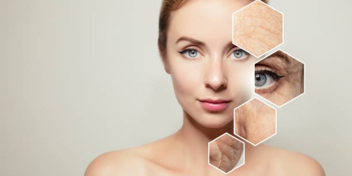 How Microneedling Treatment in Dubai Stimulates Collagen