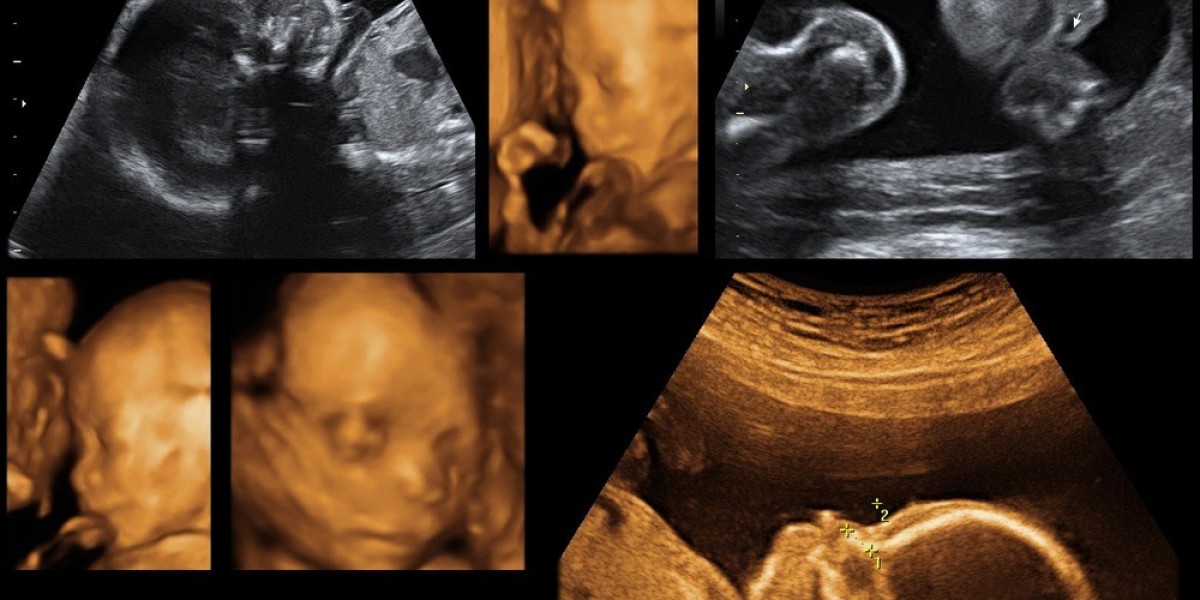 Mapping Internal Topology: The Clinical Power of 3D Ultrasound Imaging