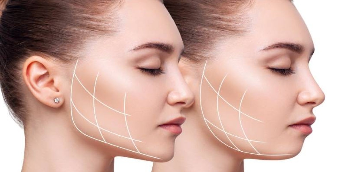 Jaw Surgery in Islamabad and balancing function with aesthetics