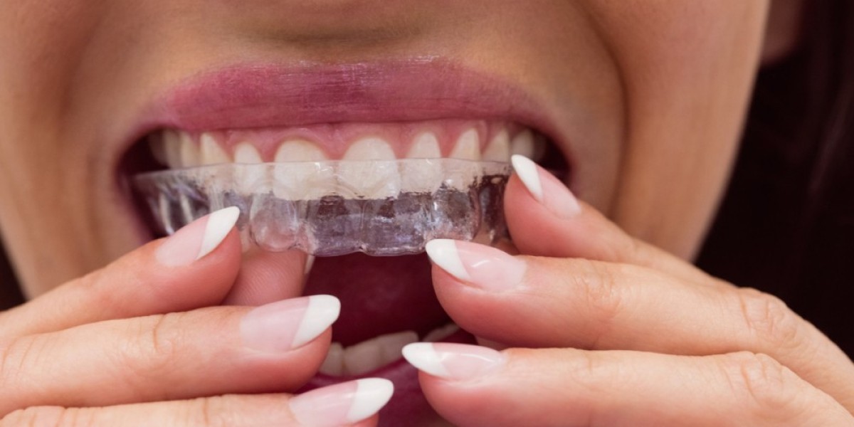 Invisalign vs Braces: Which Should You Choose?