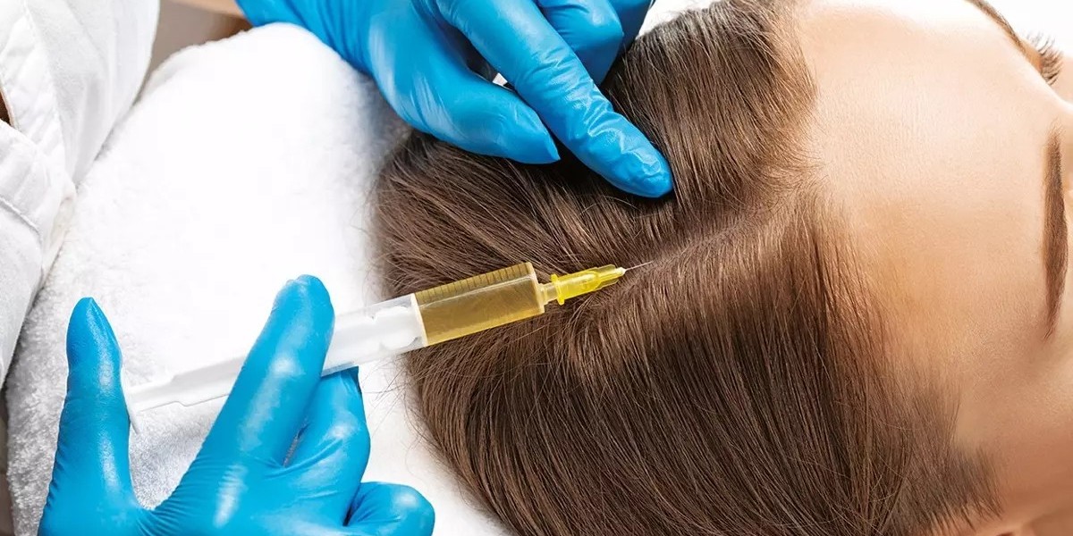 PRP Hair Treatment and Lifestyle Tips for Better Hair Growth