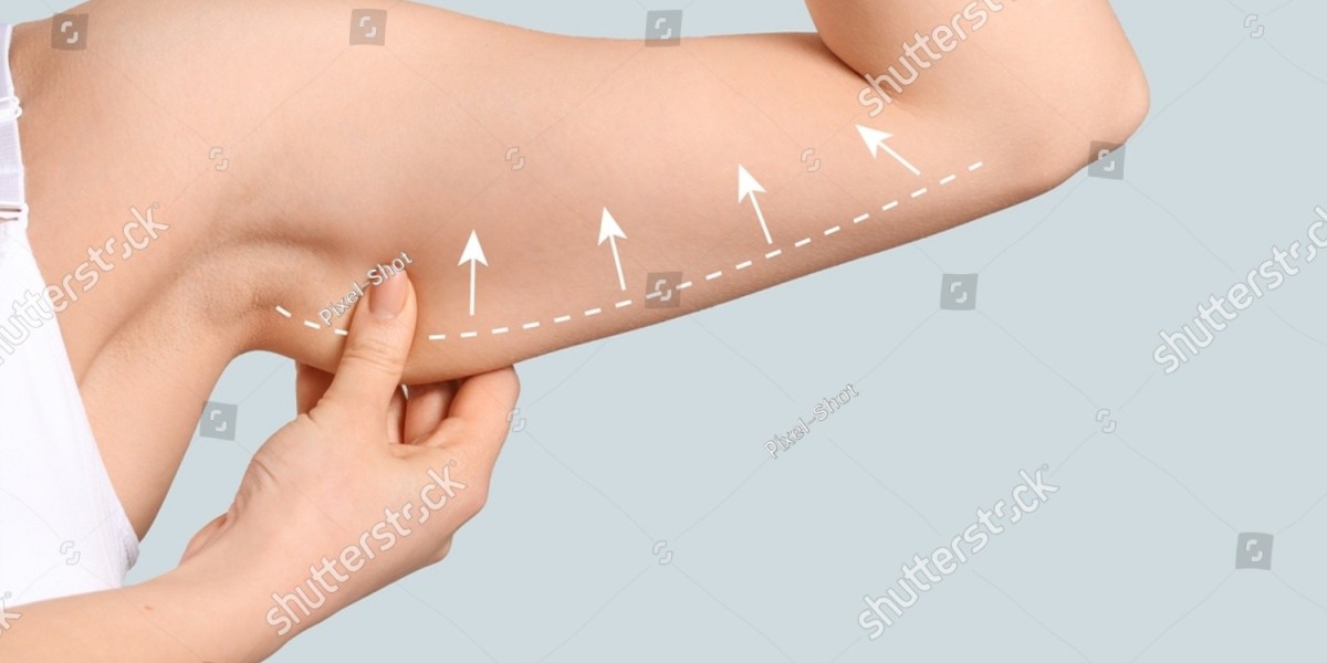Enhancing Your Confidence: The Psychological Impact of Toned Arms