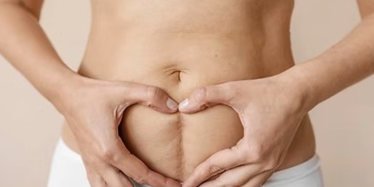 Stretch Mark Removal Glendale, AZ: Advanced Skin Treatment Solutions at MedWell Arizona