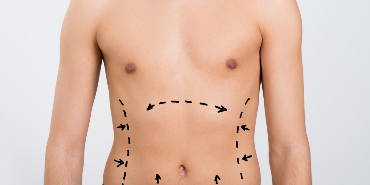 Latest Technology Used in vaser liposuction in Islamabad