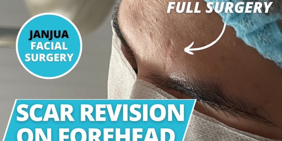 Combining Scar Revision with Other Aesthetic Treatments for Smooth Skin