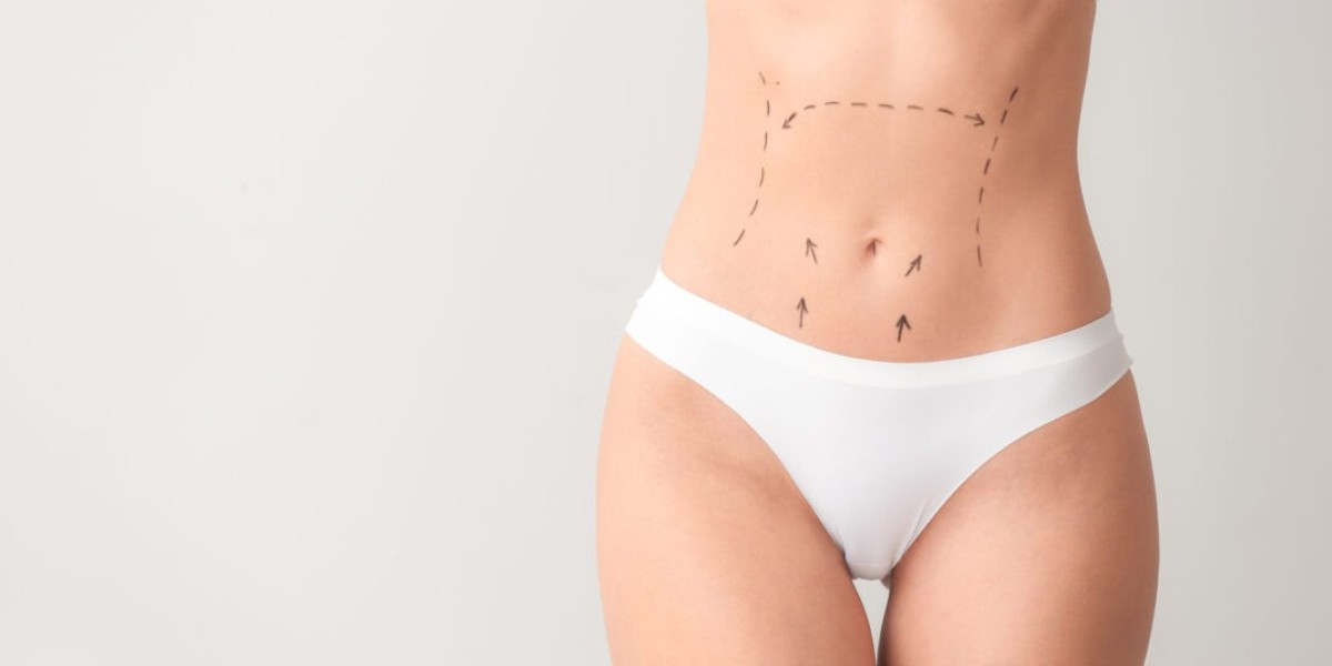 Liposuction surgery in Dubai abdomen contour solutions guide