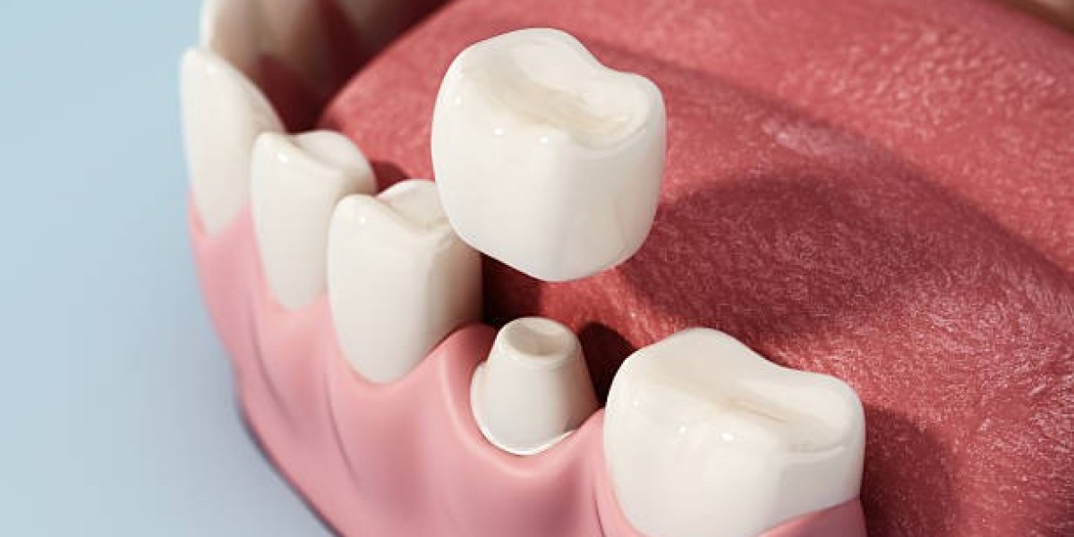 A Reliable Way to Restore Damaged Teeth and Smile Confidence Dental Crowns: