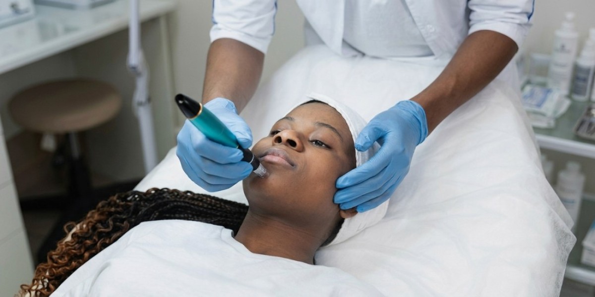 Transform Your Skin with Microneedling in Mississauga
