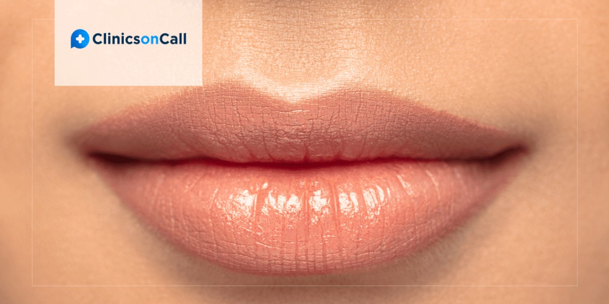 How to Achieve the Perfect Pout: Lip Fillers in Riyadh
