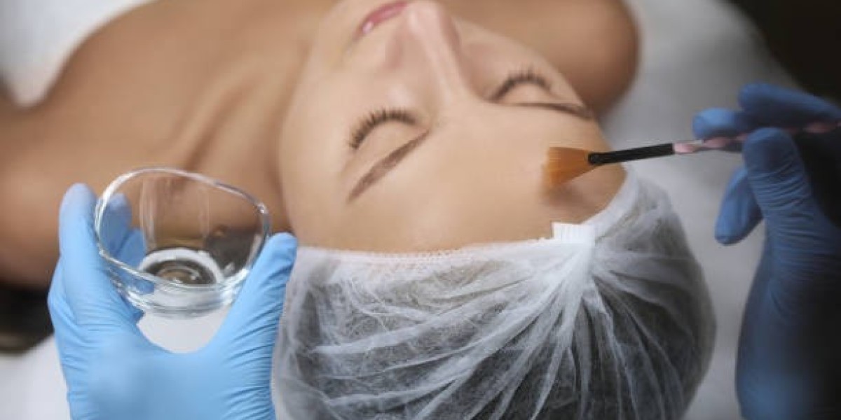 PCA Chemical Peel vs. Microneedling: Texture & Tone in Dubai