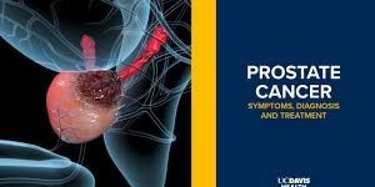 Challenges and Opportunities in the France Prostate Cancer Drugs Market