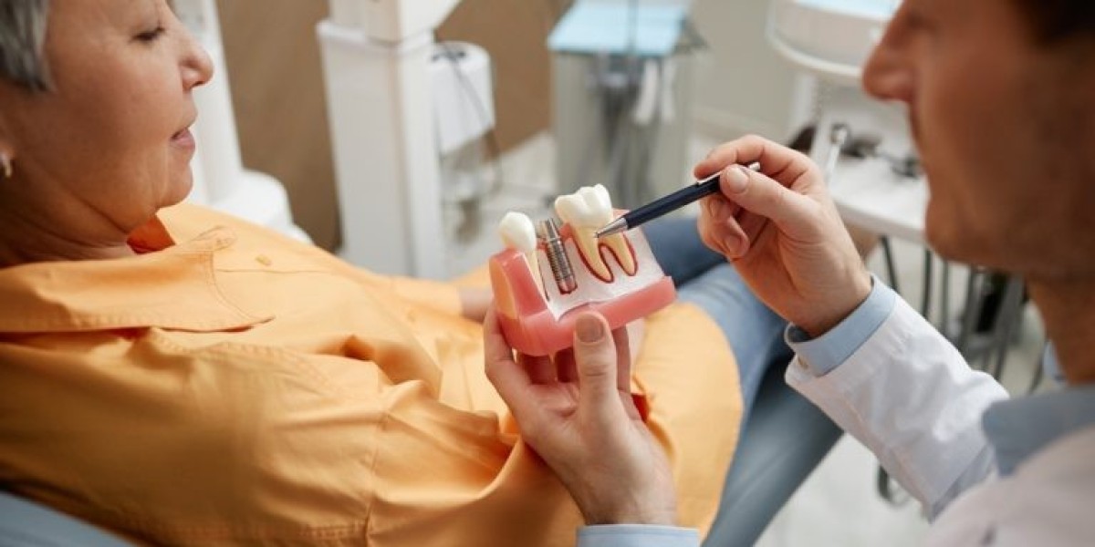 Root Canal Treatment Berkeley: Restore Your Smile with Berkeley Lake Dental
