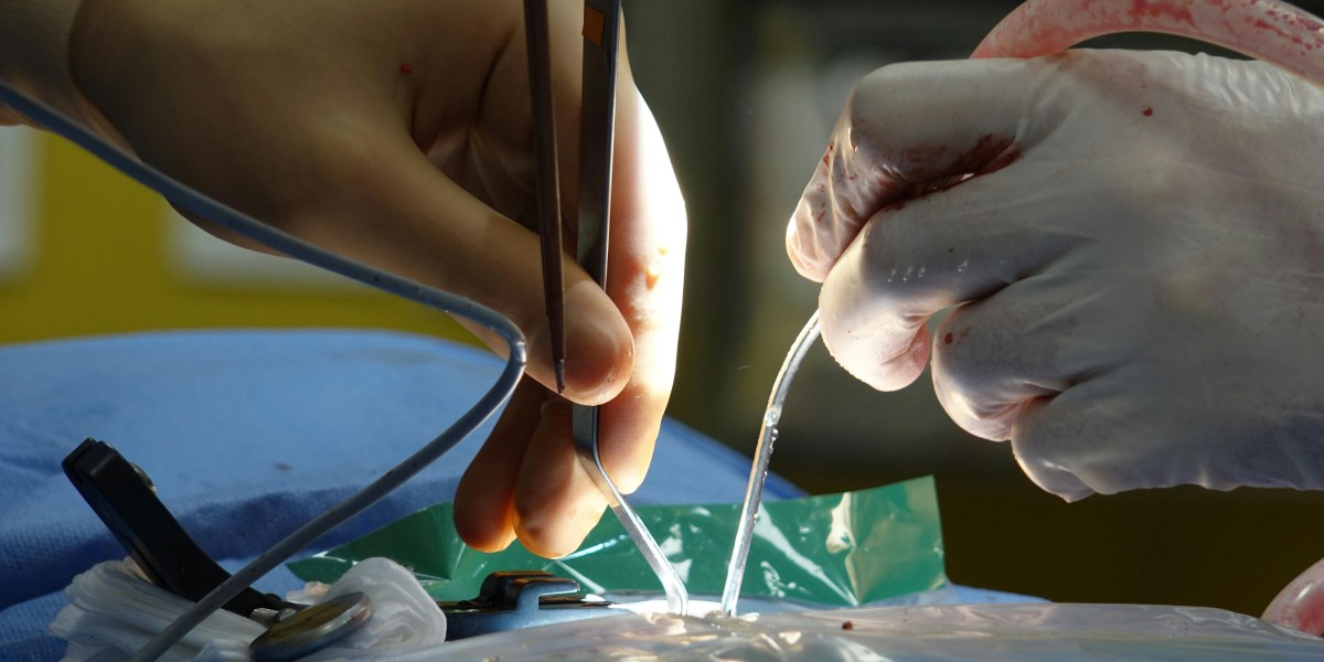 Global Lithotripsy Market Insights: Opportunities & Challenges