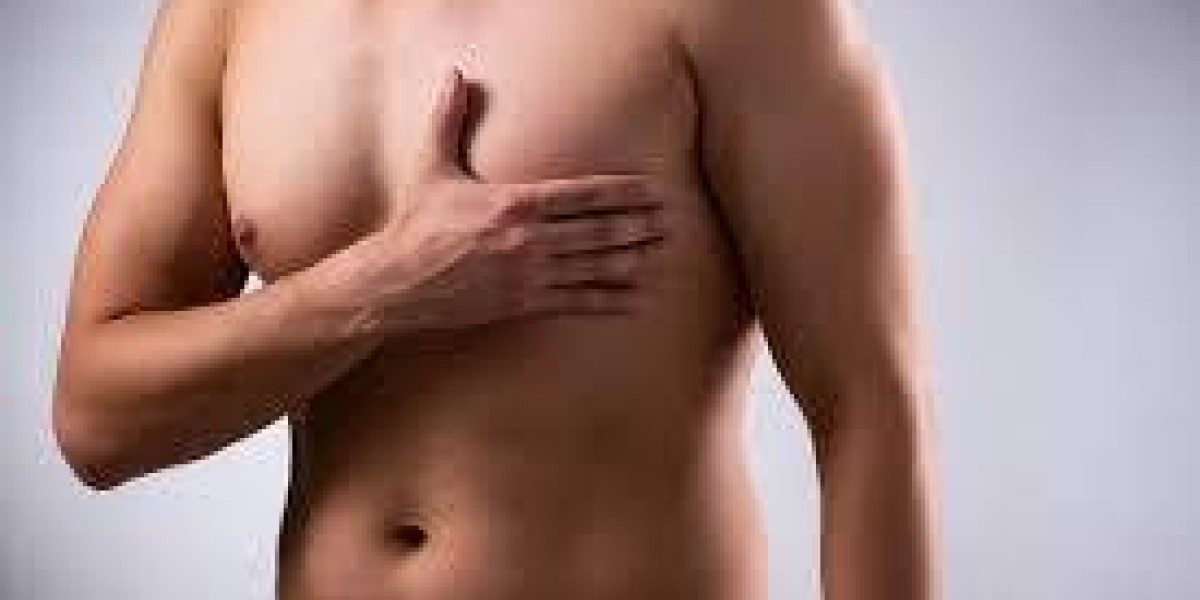 Can bodybuilding cause gynecomastia?