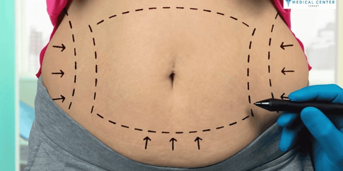 Understanding the Fat Harvesting Process: From Lipo to Injection