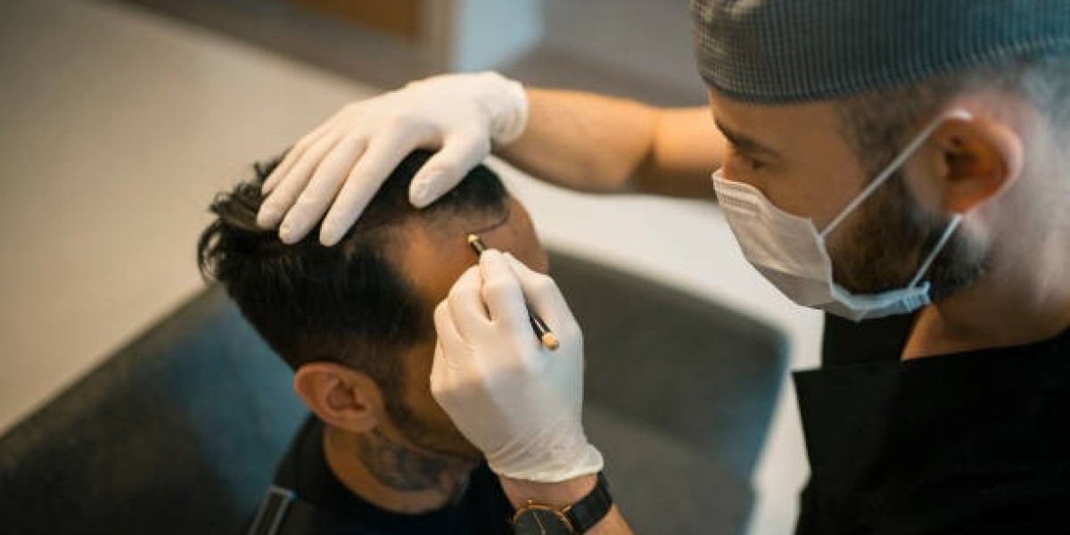 Hair Transplant in Riyadh for Women Facing Hair Thinning Concerns