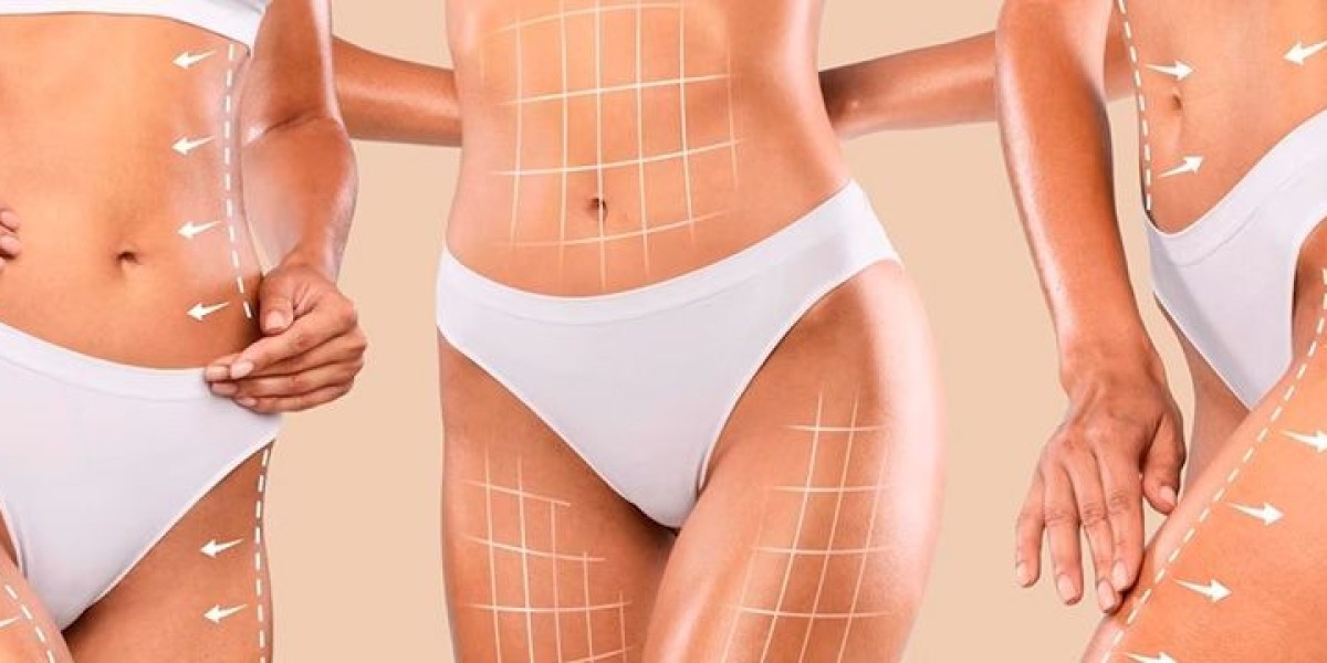 Vaser 4D Liposuction in Riyadh: The Future of High-Definition Body Sculpting