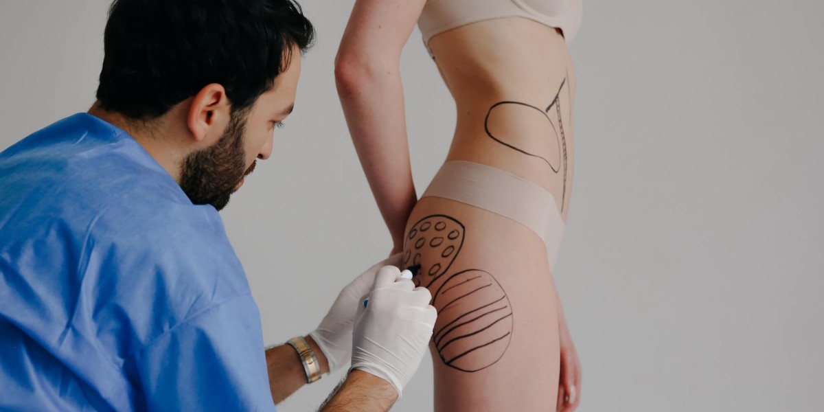 Buttock Augmentation in Dubai Treatment Journey