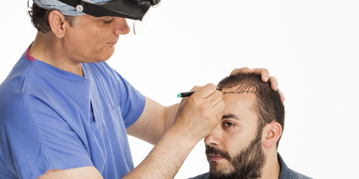 Hair Transplant in Dubai Best Age for Treatment