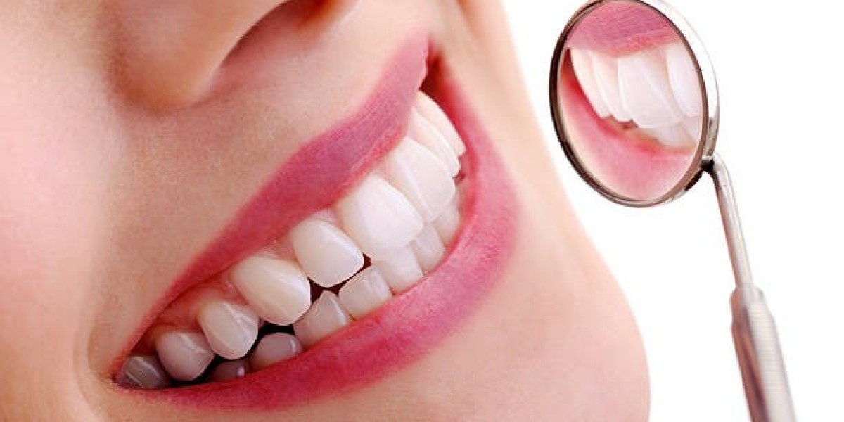 Single vs Multiple Dental Implants Brisbane: Which Option Is Best?