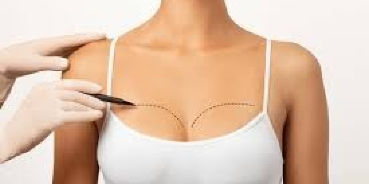 Breast Augmentation in Dubai for Balanced Feminine Silhouette