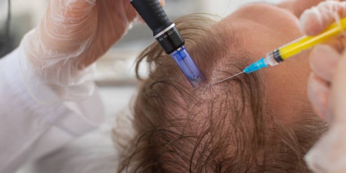 Next-Level Hair Restoration: Exosome Hair Therapy in Islamabad