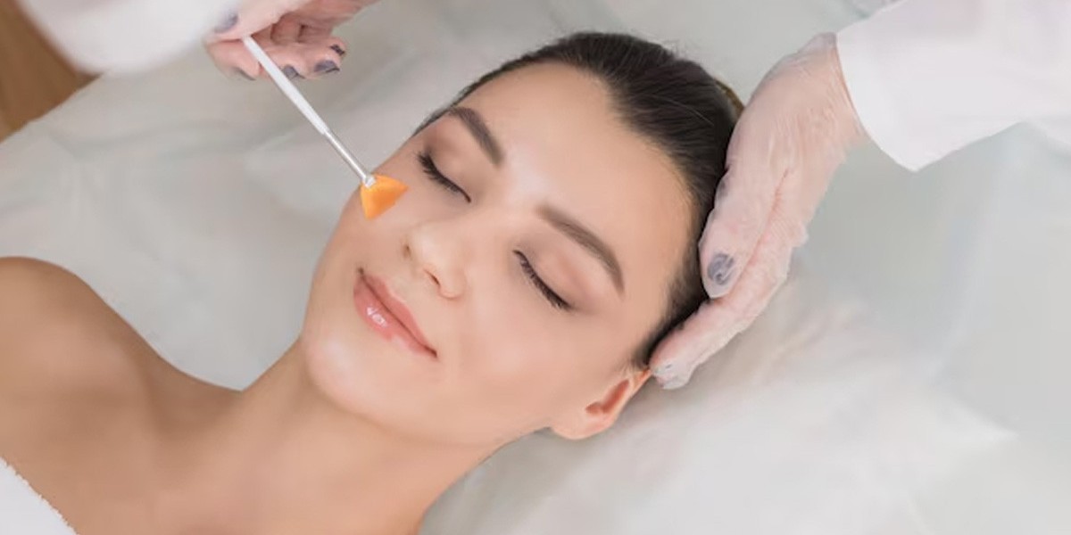 Chemical Peel Treatment: A Simple Solution for Brighter and Healthier Skin