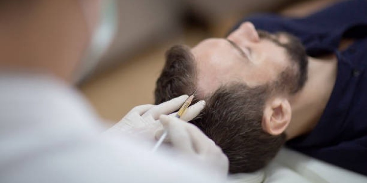 PRP Hair Treatment in Dubai vs. Laser Caps: Which Is More Effective?
