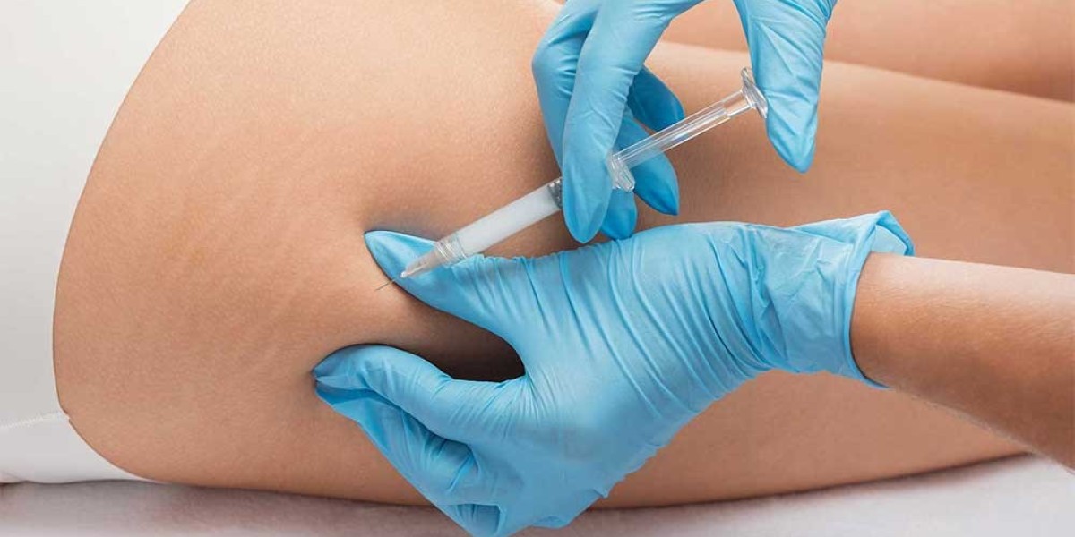 Why Choose Butt Fillers for Non-Surgical Shaping?