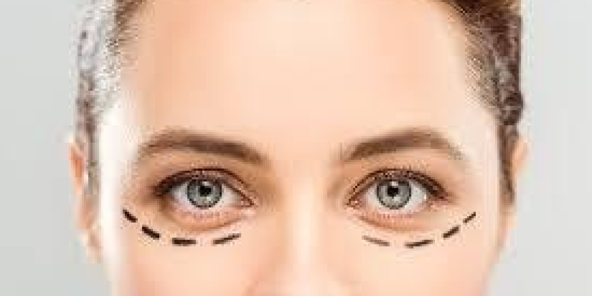 Why Is Eyelid Surgery Important for Eye Aging Signs?