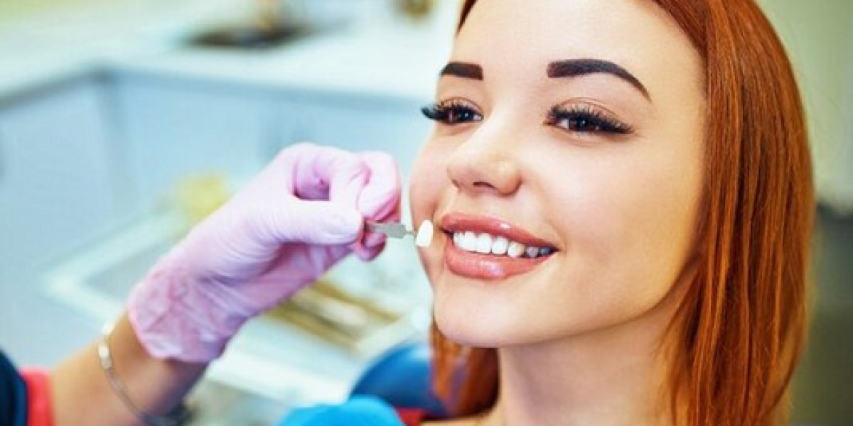 Custom-Made Dental Veneers: The Perfect Solution for Chipped Teeth