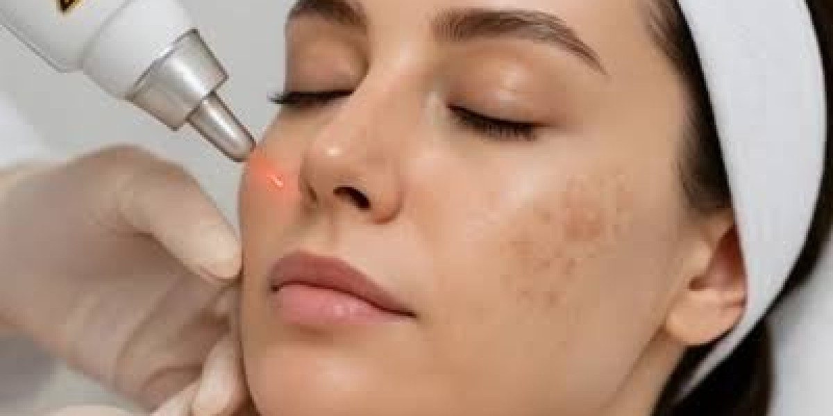 How Skin Pigmentation Treatment in Dubai Helps Restore Even Skin Tone