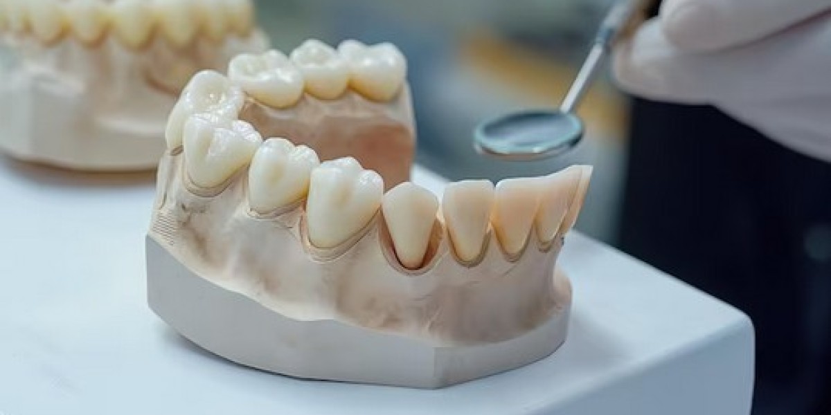 Closing the Gap: What Dental Bridges Can Do for Your Smile