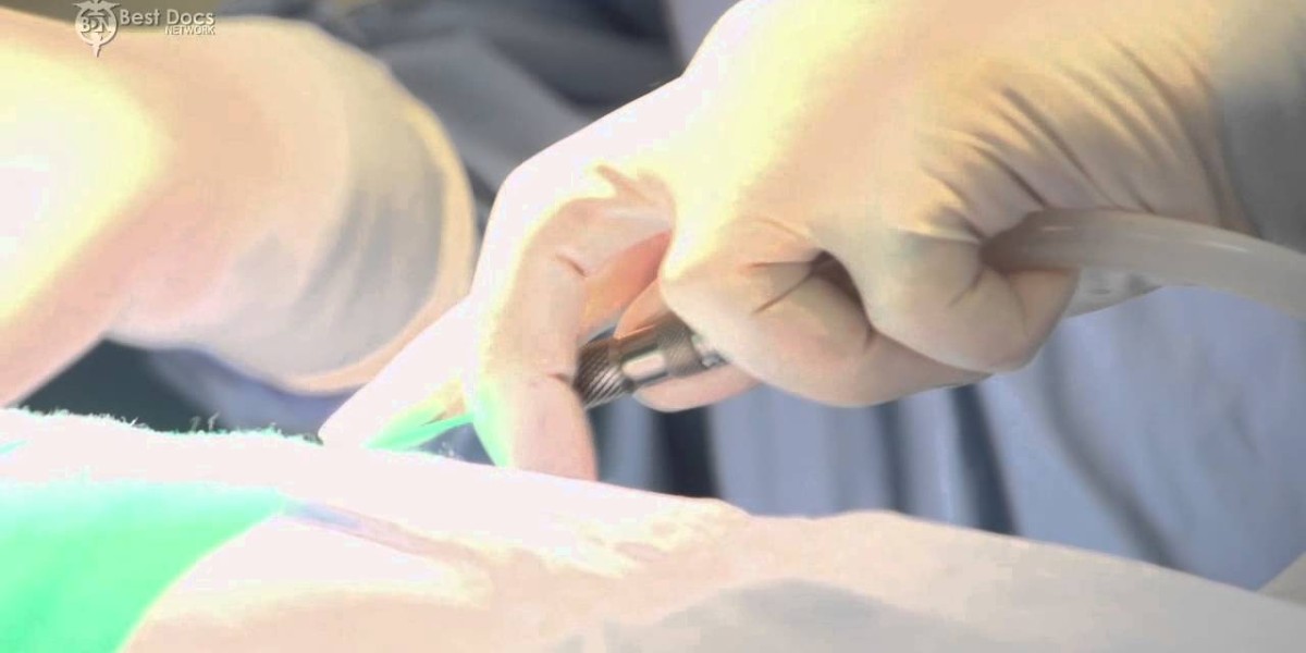 The Complete Labiaplasty Journey in Riyadh