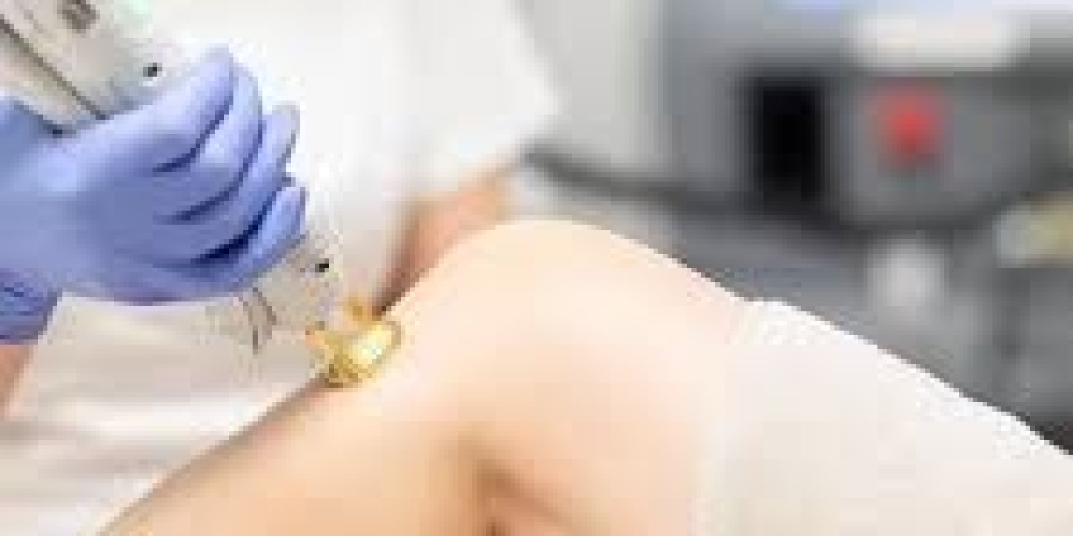 Full Back Laser in Dubai | Complete Guide to Smooth and Hair-Free Skin
