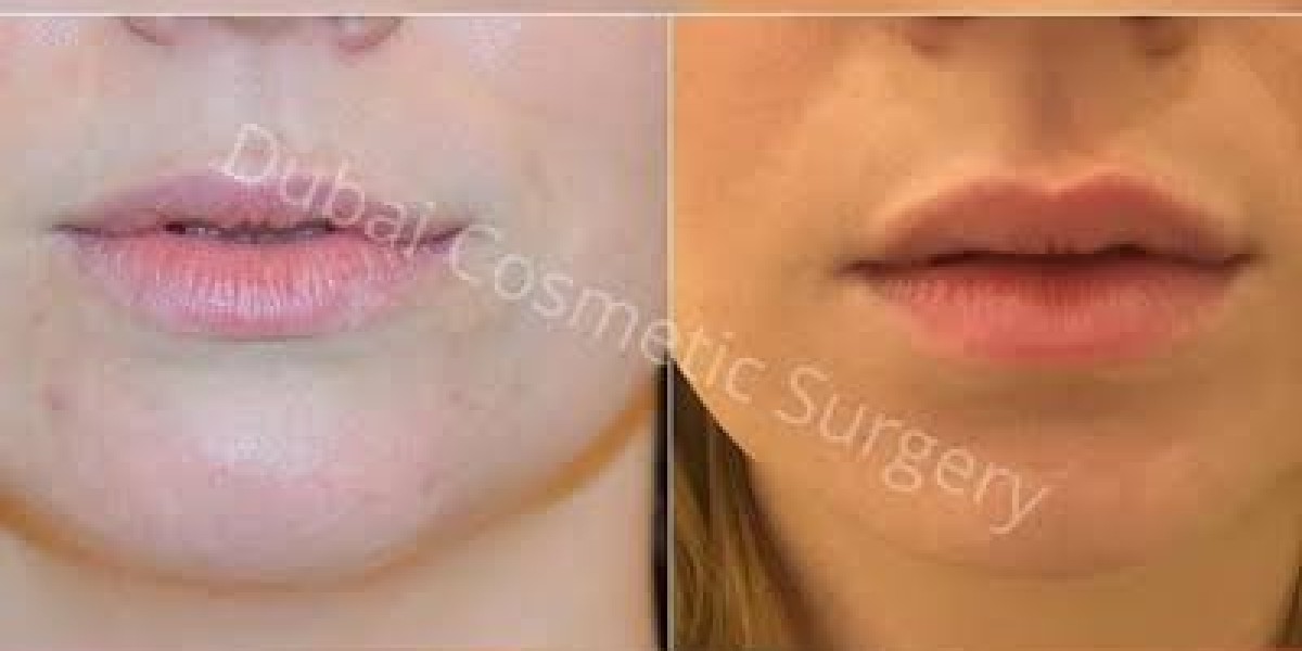 Cosmetic Surgery in Dubai: Enhancing Confidence Through Safe Aesthetic Transformation