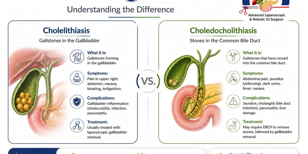 Choledocholithiasis vs. Cholelithiasis: Understanding the Difference