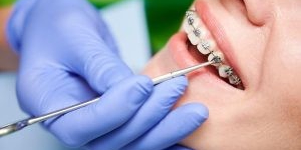Orthodontics in Dubai: Modern Smile Alignment Options for All Ages