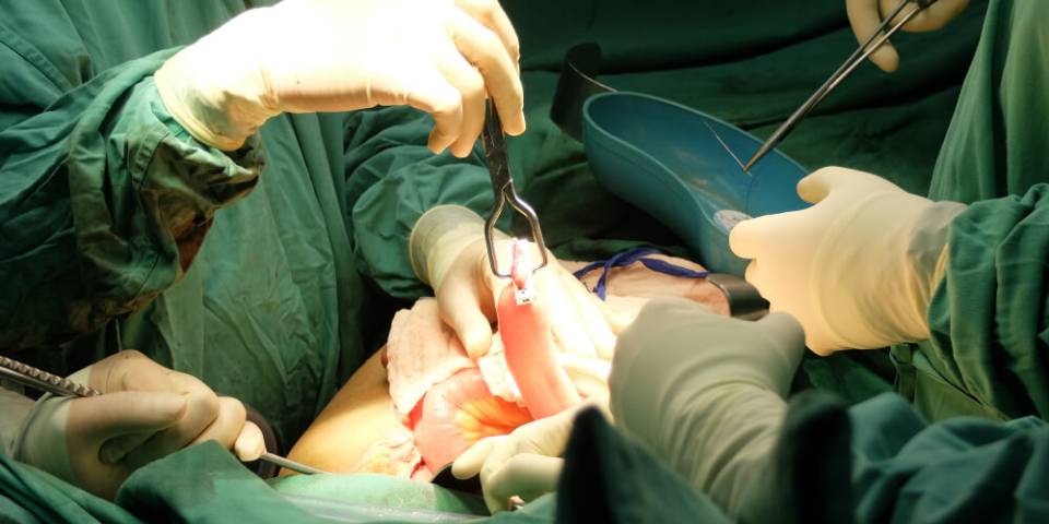 Colorectal Surgeon in Bangalore | Dr. Bhushan Chiattawadagi- Best Gastroenterologist in Bangalore