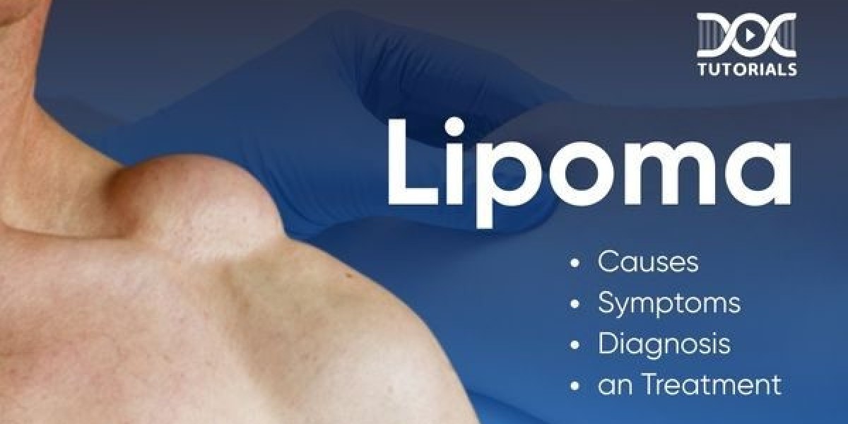 Post-Operative Care Tips After Lipoma Removal in Riyadh