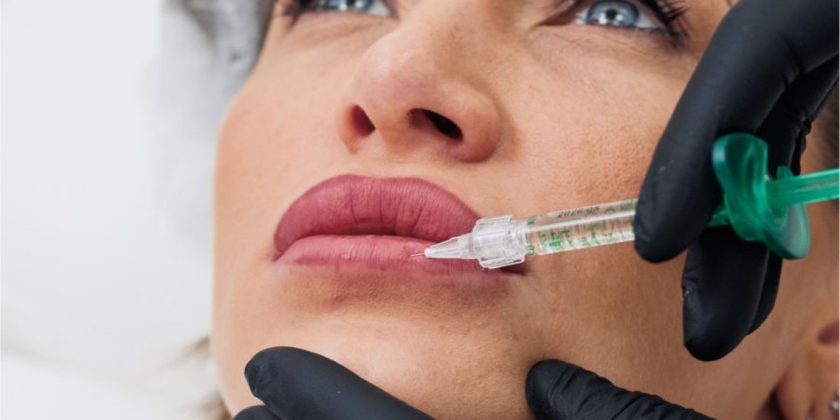 What Are the Top Benefits of Restylane Treatments?