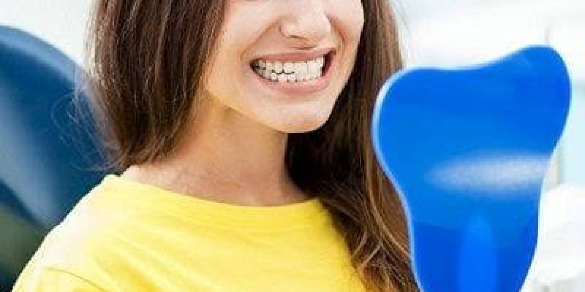 Treatment of Fractured Teeth in Dubai: Effective Ways to Restore Your Smile