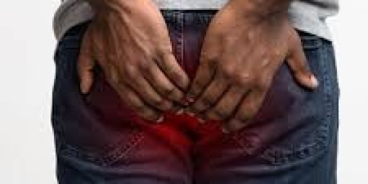 Hemorrhoid Treatment in Dubai: A Complete Guide to Finding Relief and Restoring Comfort