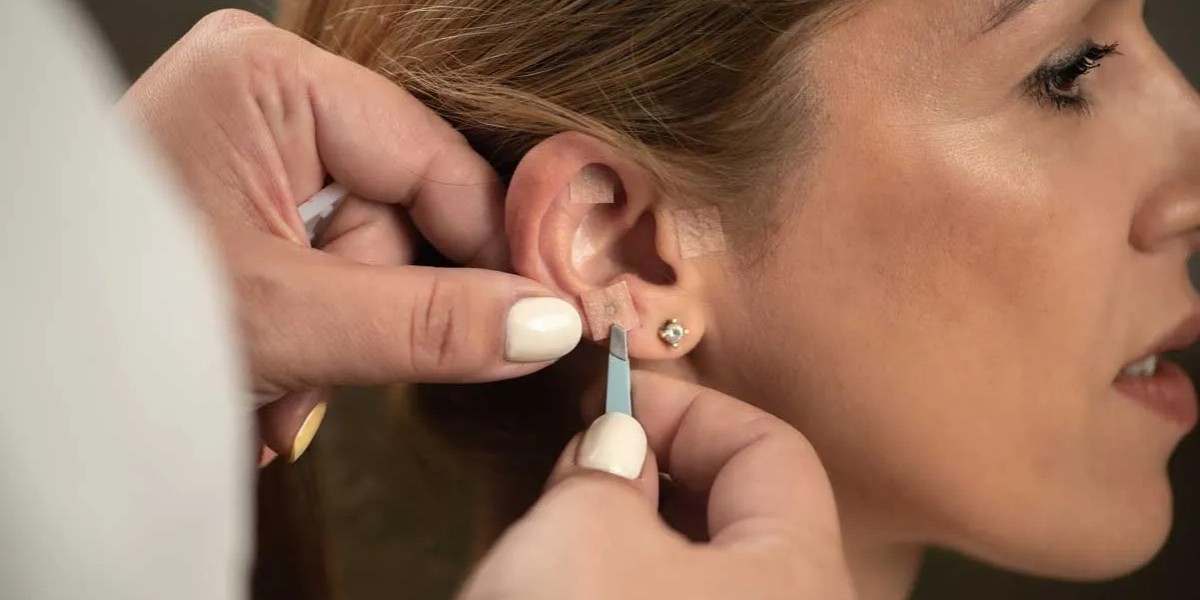 Is Earlobe Correction Surgery Suitable for Everyone?