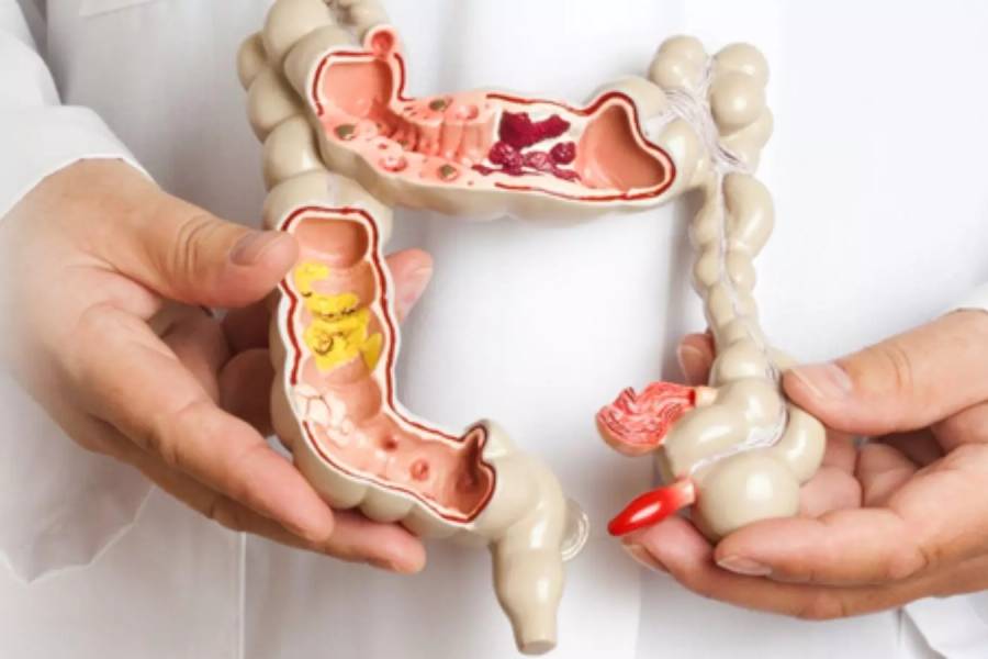 Best Colorectal Surgeon in Chennai | Robotic-Assisted Laparoscopic Surgery | Dr. Srivatsan Gurumurthy