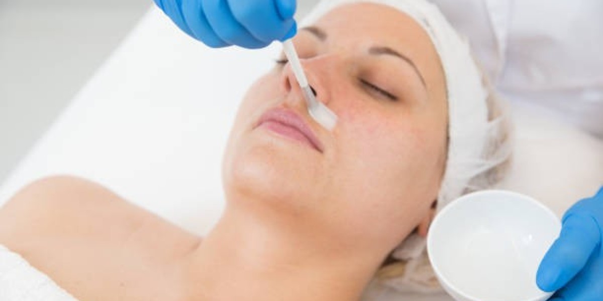 Deep Cleansing Chemical Peels in Dubai Explained